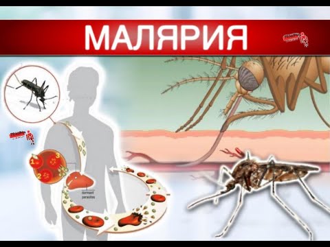 Малярия