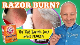 RAZOR BURN? Try this BAKING SODA home Remedy!