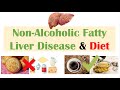 The Best 27 Fatty Liver Diet Menu Plan