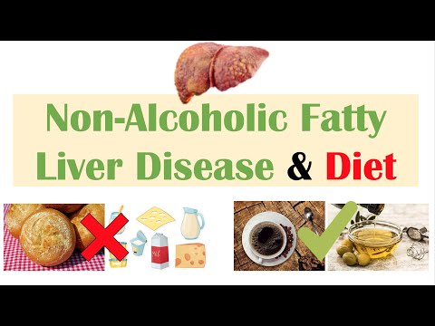 Non-Alcoholic Fatty Liver Disease & Diet | Diets to Prevent and Reduce Severity of NAFLD