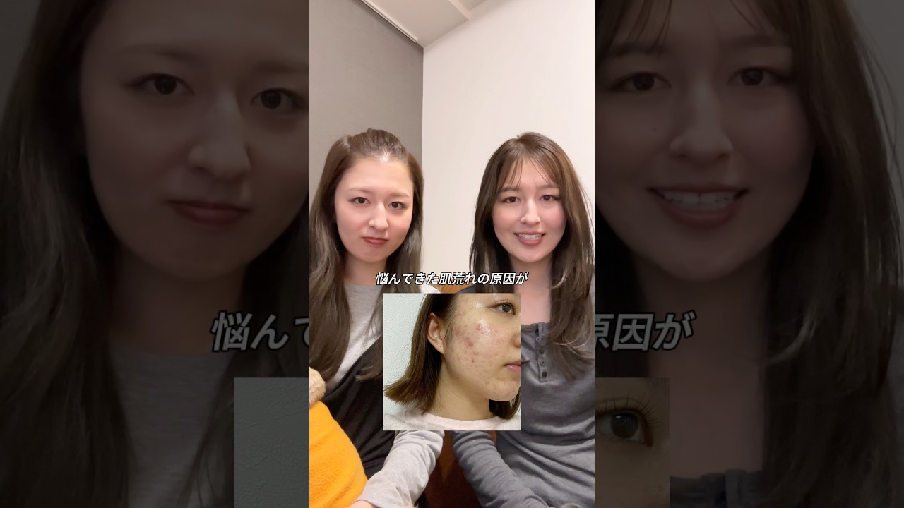 ずっと悩んできた肌荒れの原因がやっと分かりました…😭 #shorts