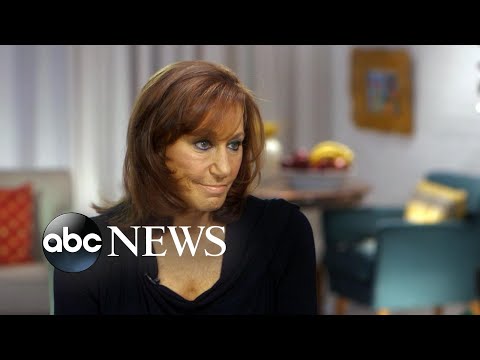 Donna Karan apologizes for defending Weinstein