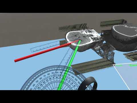 Pre-Surgical Planning 2/3 -- measurement