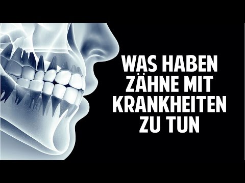 Ein dumpfer Schmerz im Rücken am Morgen Steifigkeit im Handgelenk