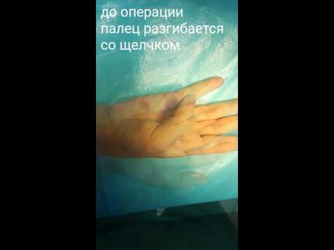 Что полезно принимать при остеохондрозе Область путового сустава