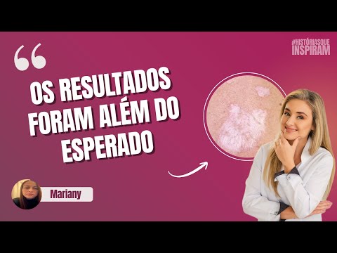 Thumbnail do vídeo
