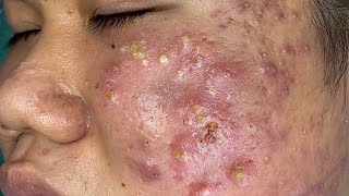 𝘚ℎ𝘢𝑟𝘦 𝘵𝑖𝘱𝑠 𝑓𝘰𝑟 𝑐𝘭𝑒𝘢𝑛𝘪𝑛𝘨 𝘢𝑛𝘥 𝘵𝑎𝘬𝑖𝘯𝑔 𝑐𝘢𝑟𝘦 𝘰𝑓 𝑦𝘰𝑢𝘳 𝘧𝑎𝘤𝑒 #35