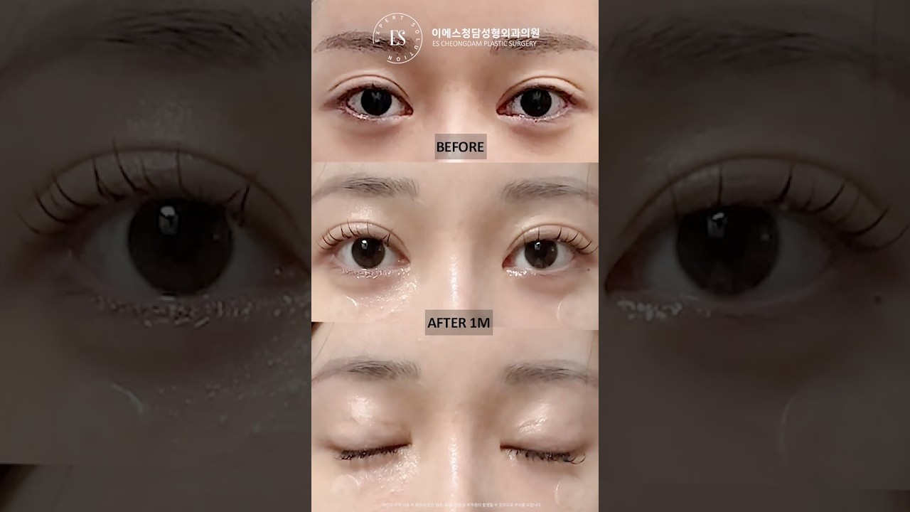 이에스 유튜브