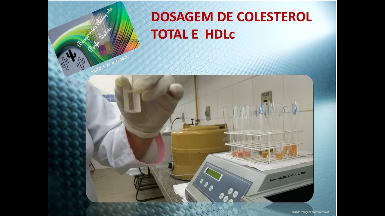 Dosagem de Colesterol total e HDLc