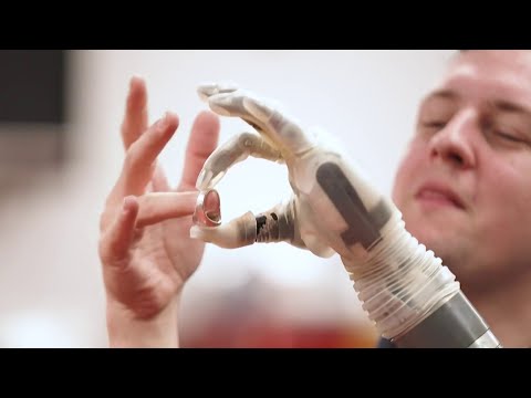 An AI-powered chip allows an amputee to control his robot prosthetic with his mind