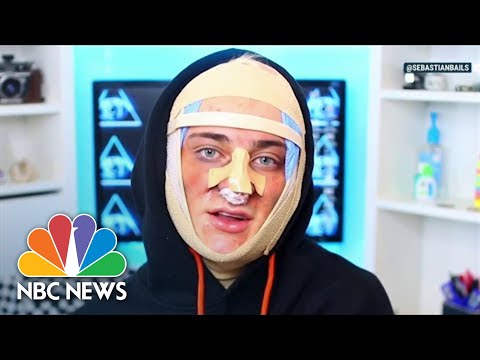 Troubling Trend: Social Media Influencers Promoting Cosmetic Procedures