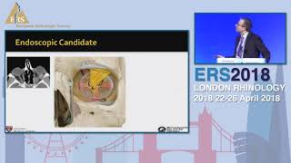 Download Lagu ERS London 2018, Intraconal Pathologies; Options And Limits, Benjamin Bleier Thumbnail
