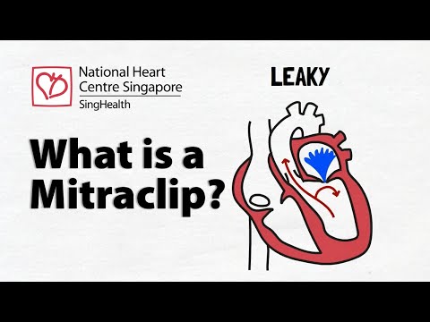 Transcatheter Mitral Valve Repair | Benefits and Risks of a Mitraclip