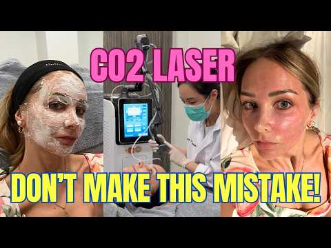 Everything you need to know BEFORE getting CO2 laser treatment 2025 | before & after | honest review