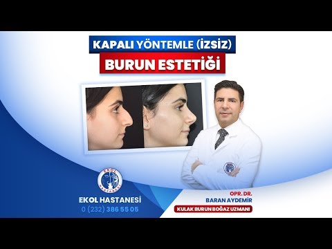 Kapalı Yöntemle (İzsiz) Burun Estetiği - Opr. Dr. Baran Aydemir - İzmir Ekol Hastanesi