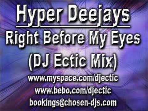 Hyper Deejays - Right Before My Eyes (DJ Ectic Mix)