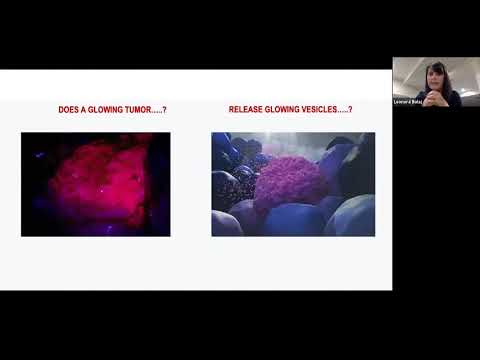 Characterization of Plasma EVs Following 5-ALA use in Malignant Gliomas by Leonora Balaj