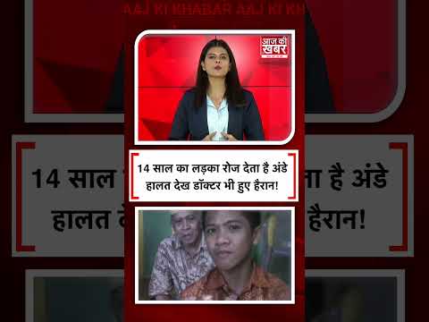 14 साल का लड़का रोज देता है अंडे हालत देख डॉक्टर भी हुए हैरान! #shorts