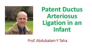Patent Ductus Arteriosus Ligation in an Infant