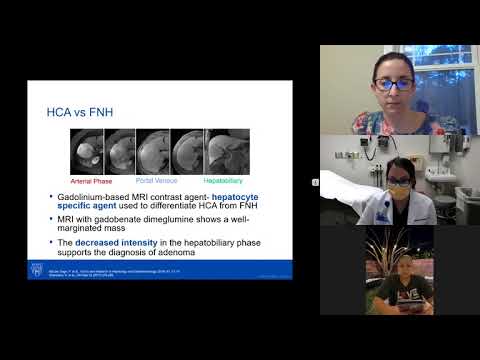 AHPBA APP Journal Club   Hepatocellular Adenomas Feb 2021 2 Trim