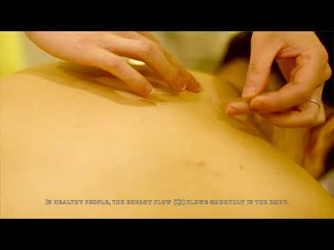 Acupuncture Treatment or Cosmetic Acupuncture Program at Beijing Tong Ren Tang (Up to 50% Off) - Second Medium