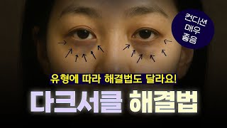 다크서클은 이렇게 해야 없앨 수 있습니다! (ft. 마인드성형외과 - 차진안 원장님)