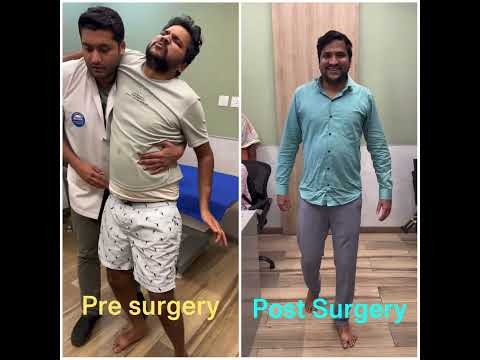 Cervical canal stenosis treatment