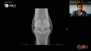 ABLA IMPORT - Aula GRATUITA RAIO-X EQUINO - Projeção Dorsopalmar