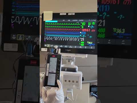 Epicardial Pacemaker checking thresholds