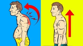 How to Fix Rounded Shoulders (PERMANENTLY)