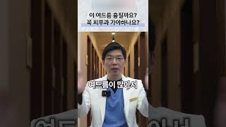 학생 여드름, 염증과 흉터 위험에 따른 진료 시점