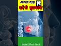 Akal Daad Ke Dard Ka Ilaj Wisdom Tooth Pain Removal In Hindi Wisdomtooth Health Shorts
