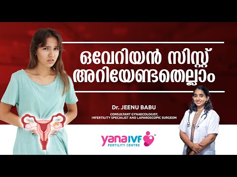 What are ovarian cysts? Signs And Symptoms Of Ovarian Cyst | Malayalam | Chocolate cyst