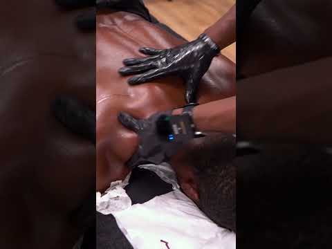 Huge knot released #massage #asmr #shorts #foryou #chiropractic #knots