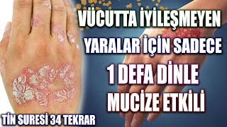 Vücutta iyileşmeyen yaralar için sadece 1 Defa Dinle ( Hastaya okunacak dua, Tin suresi fazileti)