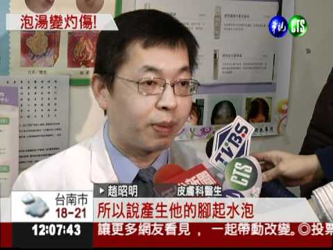 皮膚太敏感! 泡溫泉竟二度灼傷