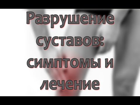Может ли от невралгии болеть спина Артроскопия коленного сустава мениски