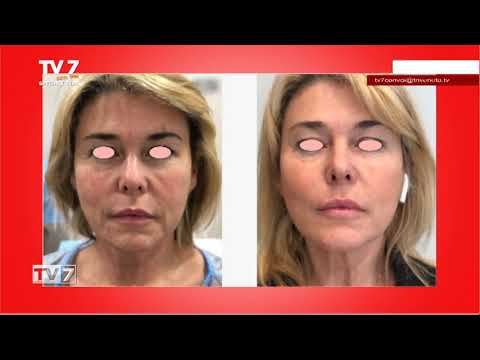 TV7 CON VOI SPECIALE SERA DEL 12/10/21 (6 di 6) - Tecniche nuovissime per il miglioramento estetico