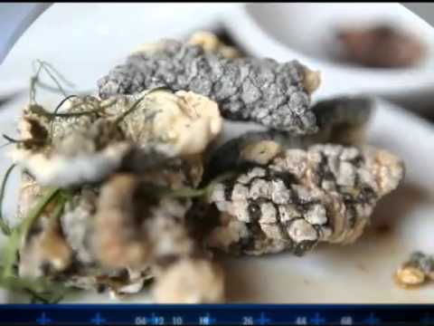 Câmera Record mostra história de mulher com excesso de pelos no rosto