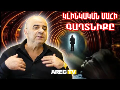 Ովքեր են հետ գալիս այն աշխարհից և ինչ է կլինիկական մահը․ Ինչ է զգում մահացած մարդը