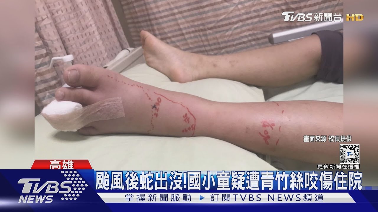 颱風後蛇出沒! 國小童疑遭青竹絲咬傷住院