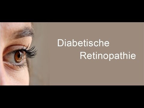 Diabetes Fuß Klinik Zakharov über Diabetes Typ-1-Buch