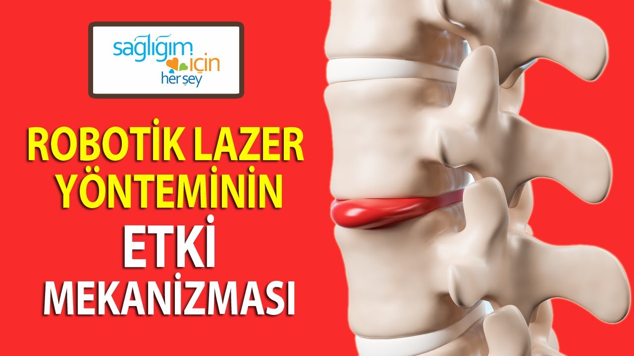 Bel ve Boyun Ağrılarının Tedavisinde Robotik Lazer Yönteminin Avantajları