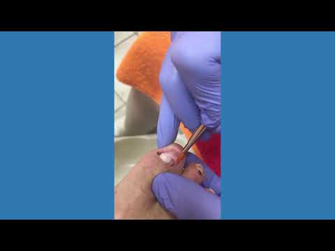 GEHWOL Nail repair Gel klar M ▻Zur Nagelreparatur | 5 ml Tube