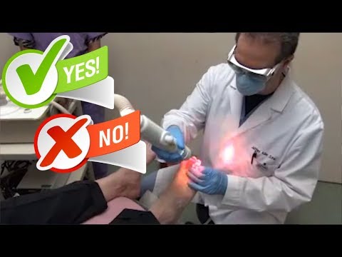 Halamang-singaw ng kuko polish minsan sa isang linggo Salіtsilova pamahid od fungus