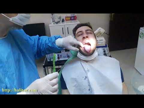 Ağız Kokusu Videosu Küçük Görseli