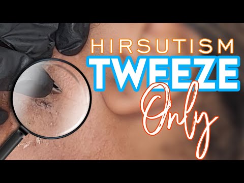 #Hirsutism// Tweeze-Only ⚠️PSA To All Serial Tweezers! 🛑Doing This!