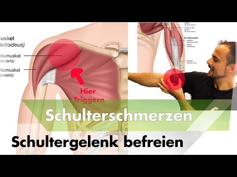 Diagnose von Bauchschmerzen und den unteren Rücken Der Schmerz des Gebens an der Leiste zurück