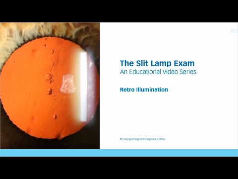 The Slit Lamp Exam – Episode 5, Retro Illumination