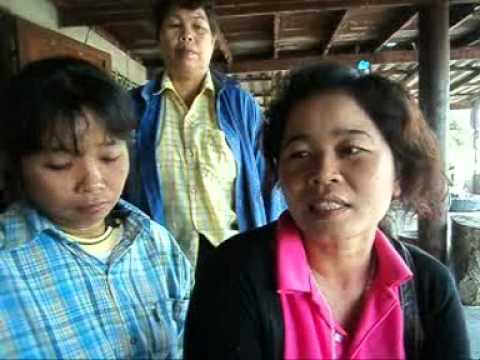 การรักษา SDA ของโรคสะเก็ดเงินที่เล็บ ถ้าโรคสะเก็ดเงินใช้ไม่ว่าจะเป็นในกองทัพ
